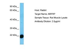 ARFRP1 Antibody, Novus Biologicals 100 &mu;L; Unconjugated:Antibodies,